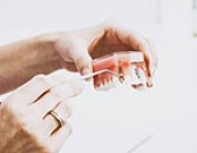 Dental Implant FAQs