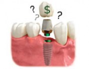 How Much Do Dental Implants Cost In Truckee/Tahoe?